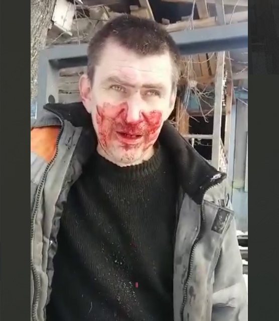 Кузбасс: Сергей Шереметьев заявил об избиении со стороны 